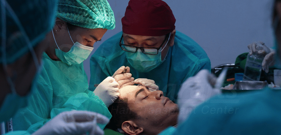 Long Hair Transplant